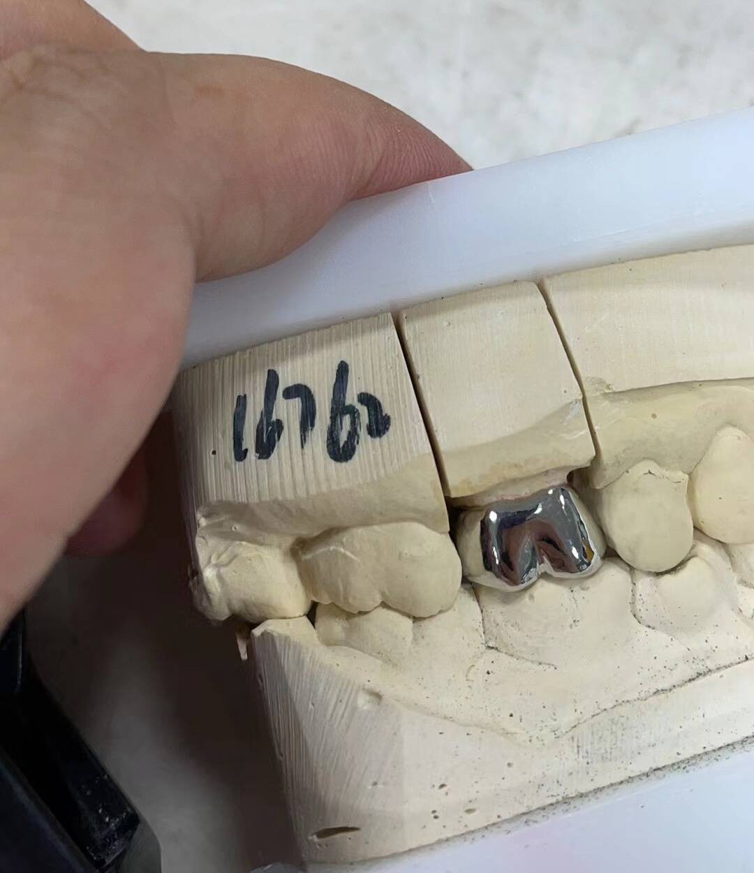 加拿大义齿加工厂,义齿公司,假牙加工厂