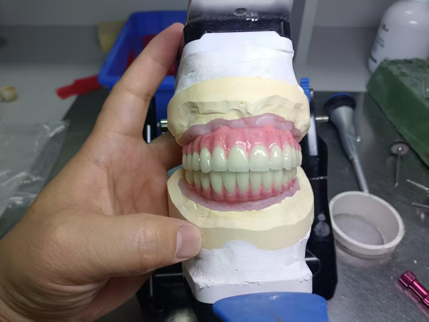 加拿大义齿加工厂,义齿公司,假牙加工厂