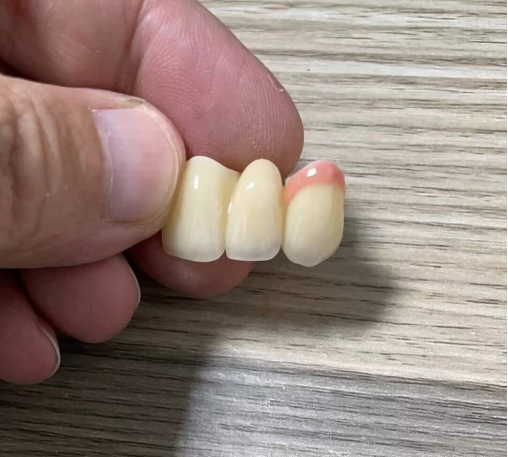 加拿大义齿加工厂,义齿公司,假牙加工厂